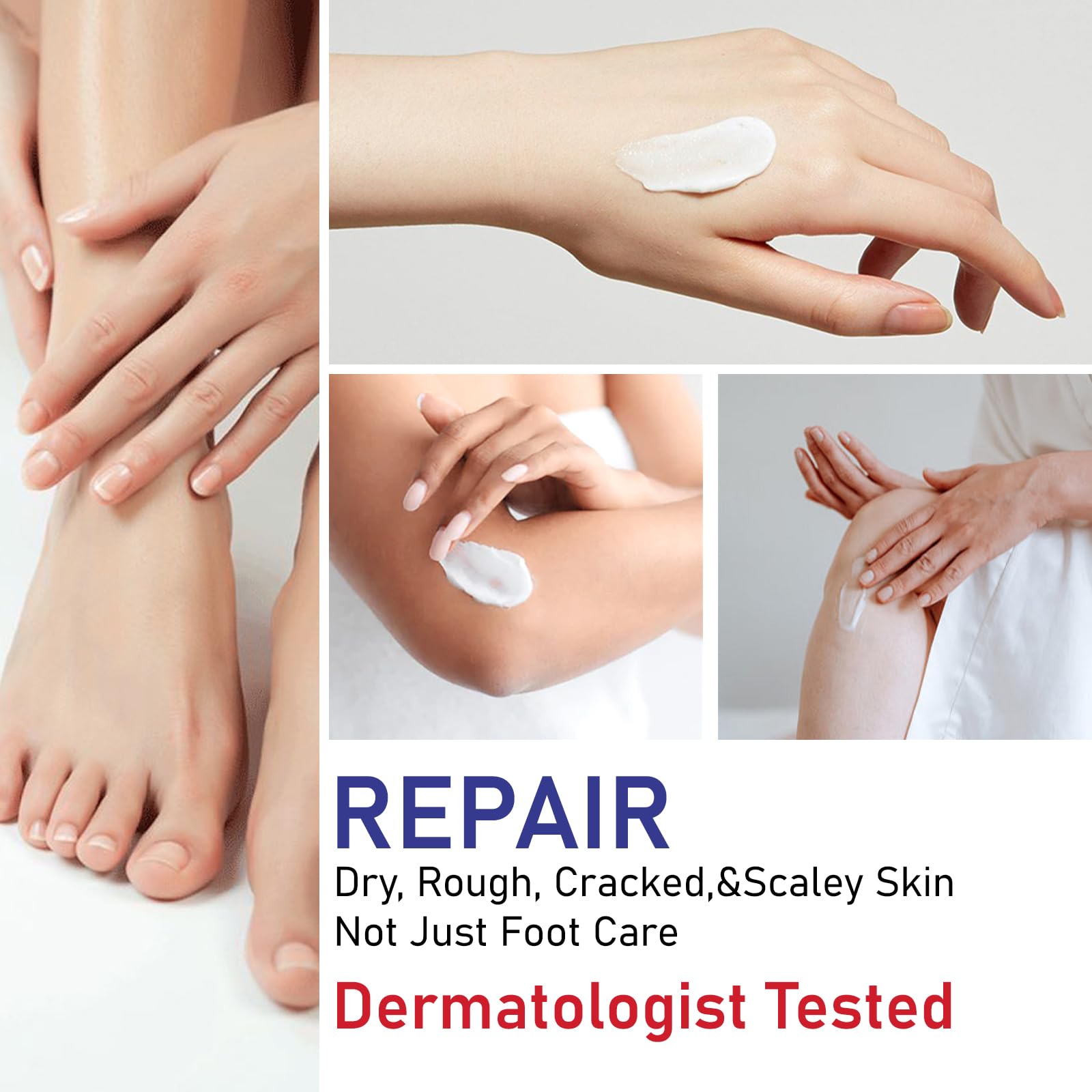 OUKEYA Urea Cream may minimize appearance of corns and calluses.