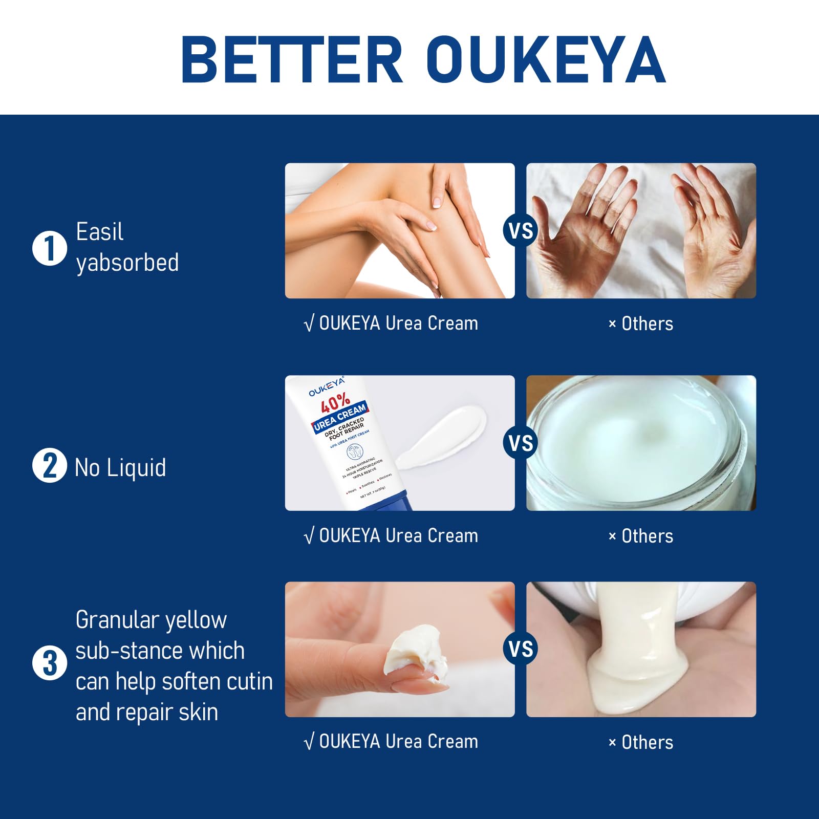 OUKEYA Urea Cream helps soften cracked heels and rough skin.
