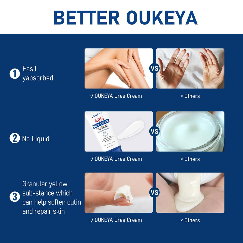 OUKEYA Urea Cream helps soften cracked heels and rough skin.