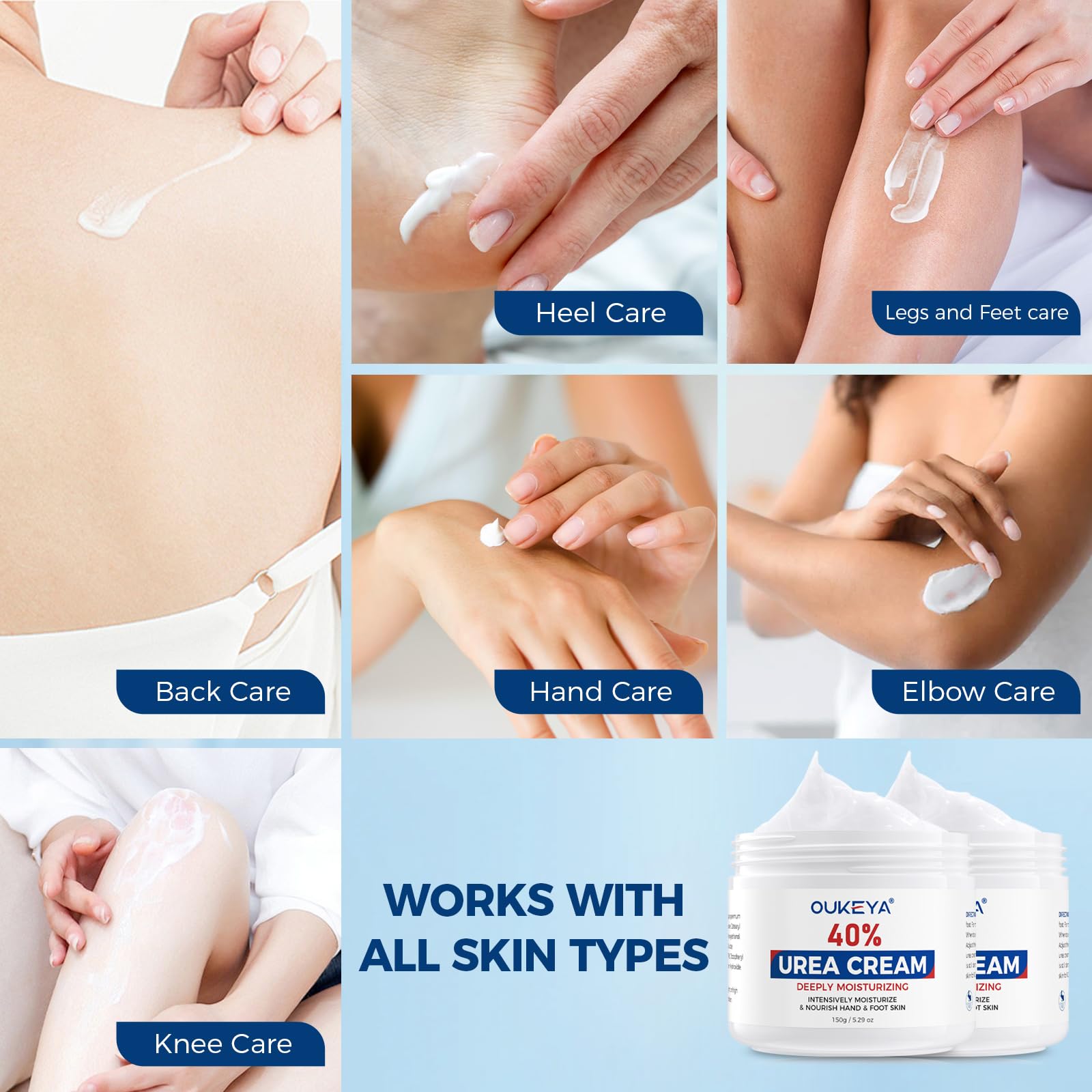 Application on knees and elbows with OUKEYA 40% urea cream.