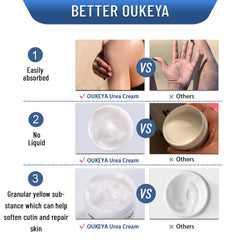 OUKEYA Urea Cream pump dispenser for easy daily use