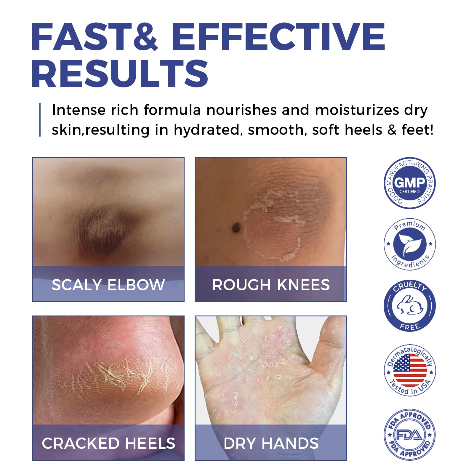 OUKEYA Urea Cream texture demonstrates fast absorption