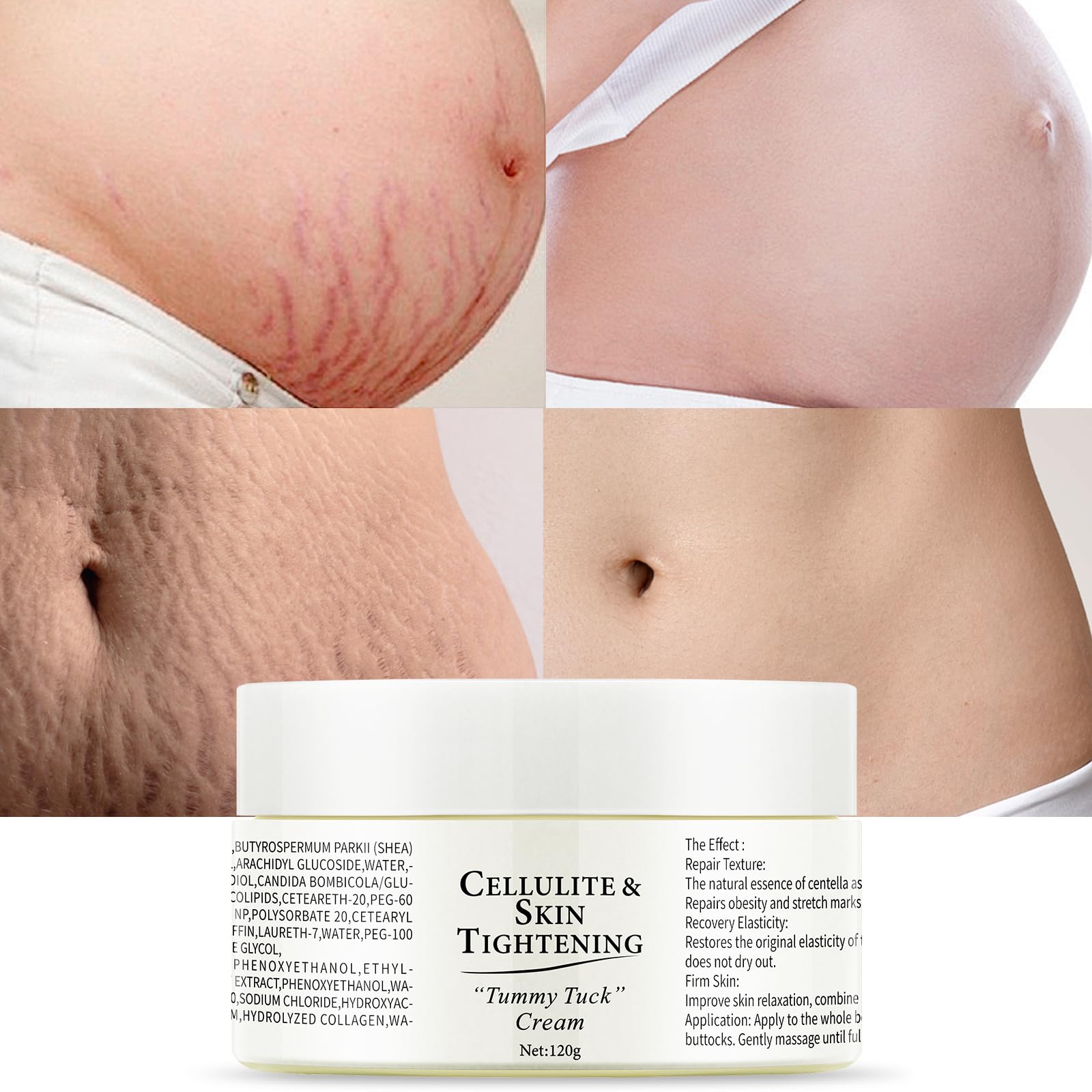 OUPEICHARM stretch marks cream bottle demonstrates hydration and gentle scar care.