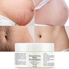 OUPEICHARM stretch marks cream bottle demonstrates hydration and gentle scar care.