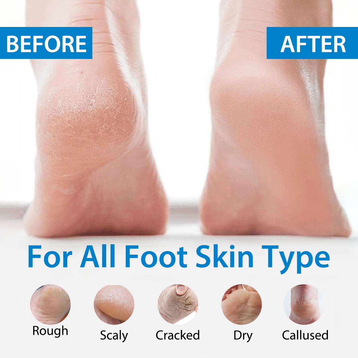 OUPEICHARM Urea Foot Cream closeup texture highlighting rich, moisturizing formula for feet.