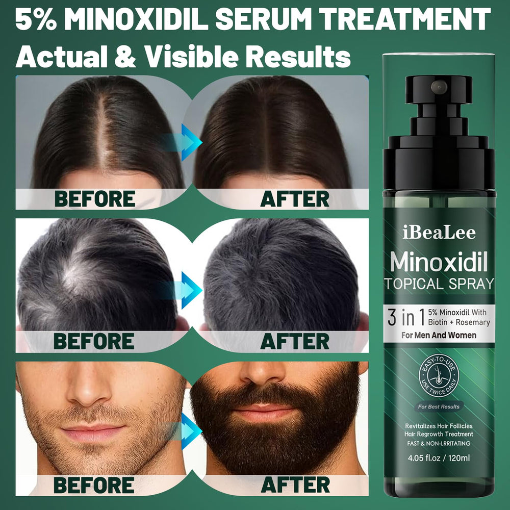 OURMUST Minoxidil with biotin and rosemary ingredients illustration highlighting added nourishment.