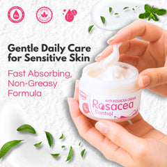 Ovante rosacea cream texture soothing facial redness areas