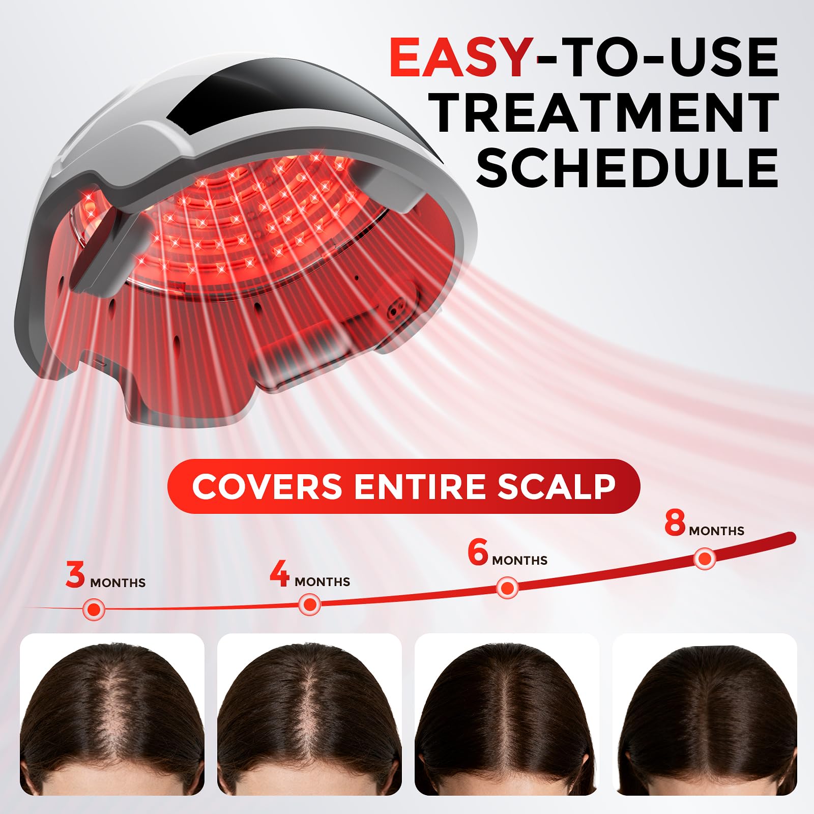 OVEKPA hair growth helmet enables focused follicle stimulation through light therapy.