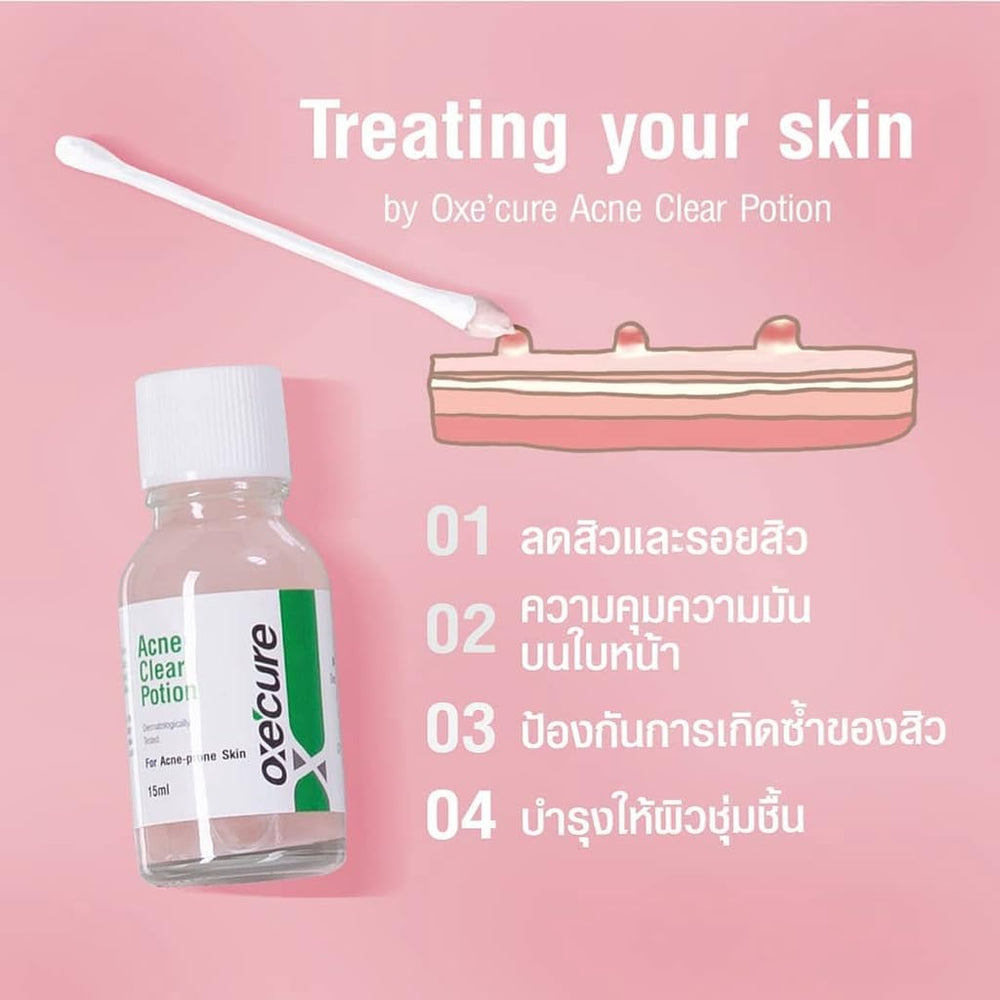 Oxe-cure Acne Clear Potion ingredients listed on the packaging.