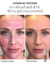 Close-up of Oxygenetix Oxygenating Foundation Creme on skin delivering natural coverage.