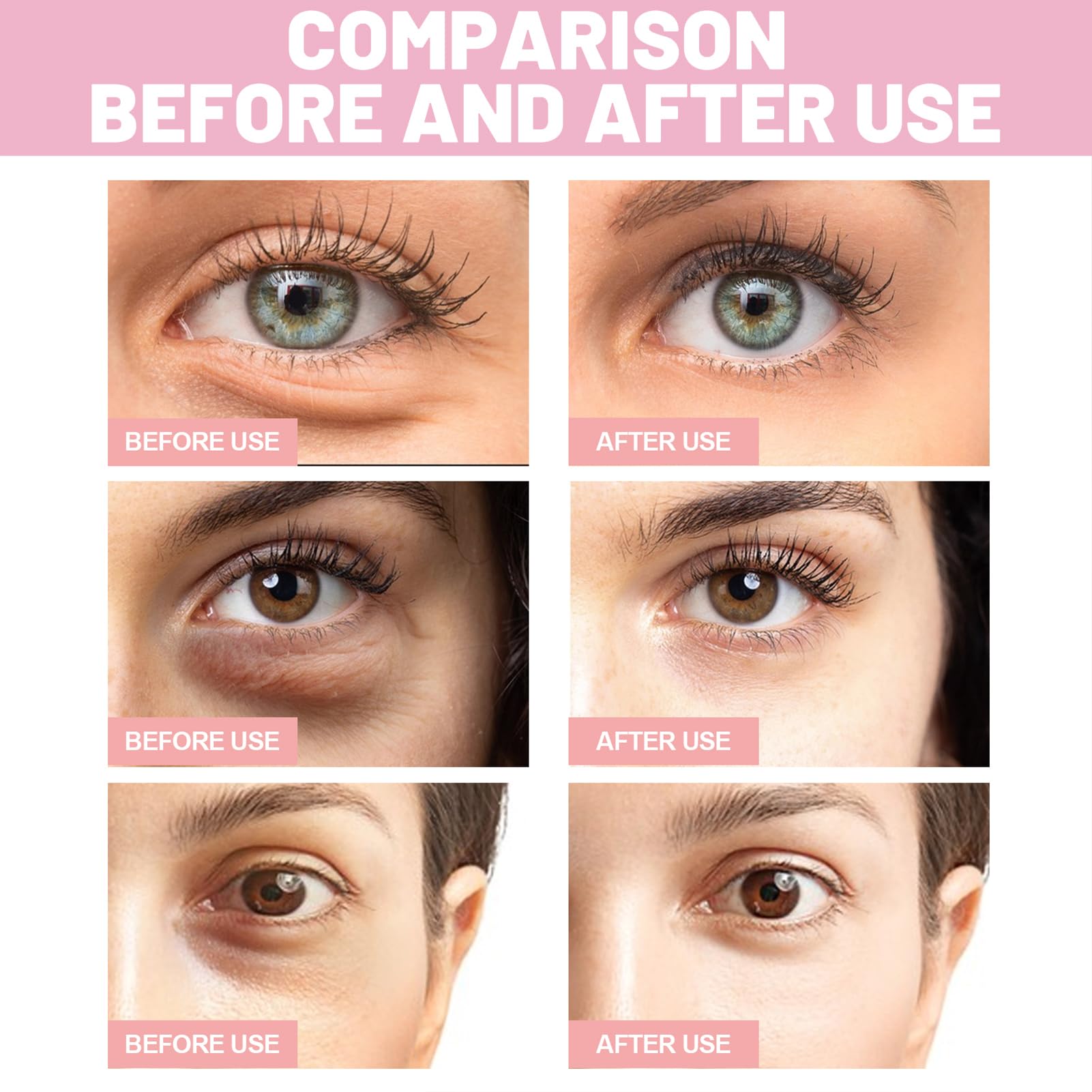 OYKOSE Instalift patch with niacinamide supports brightening around the eye area