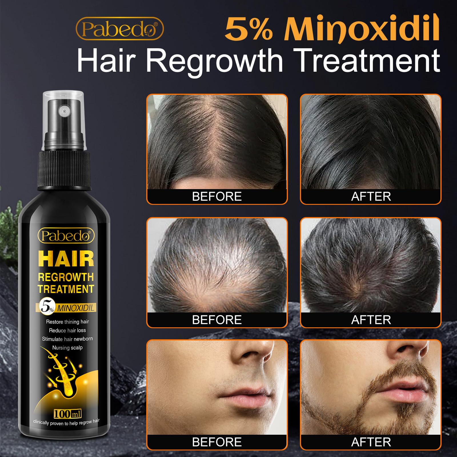 Pabedo beard growth spray in action suggests fuller beard potential.