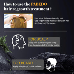 Pabedo Minoxidil hairline application targets thinning areas.