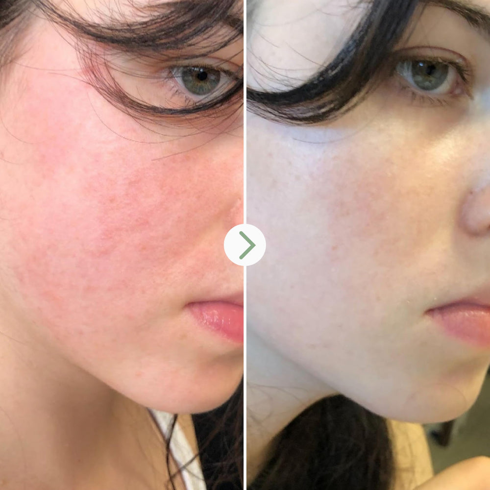 PAI SKINCARE Light Fantastic ceramide-Schisandra graphic emphasizes barrier support and soothing benefits.