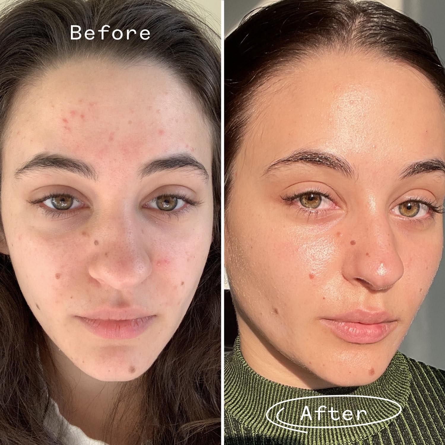 Pai Skincare night routine demonstration with application steps