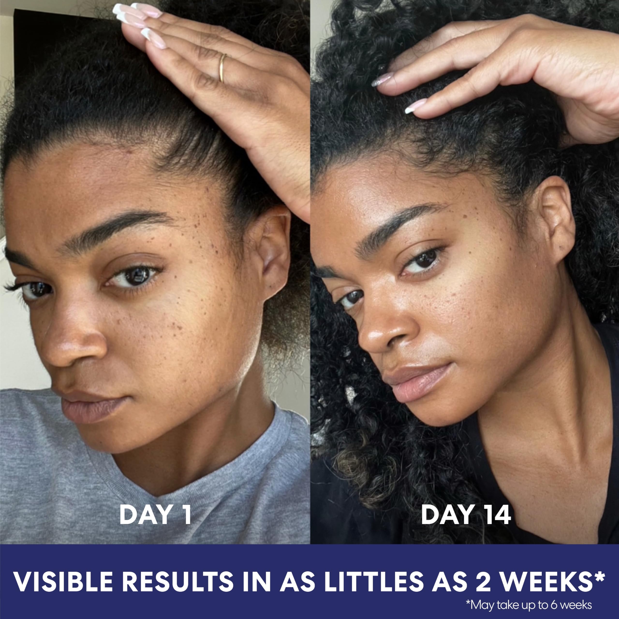 Even tone improvement focus for face and body care routines