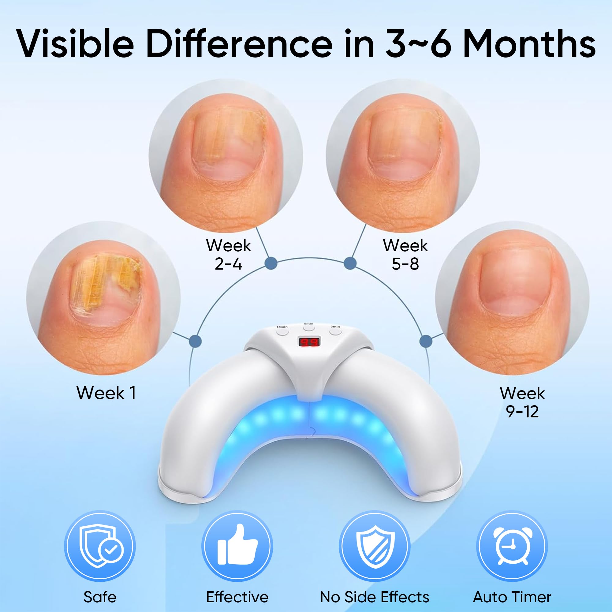 Panimosi surface contact design delivers thorough nail conditioning across nails.