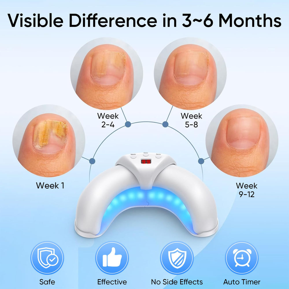 Panimosi surface contact design delivers thorough nail conditioning across nails.