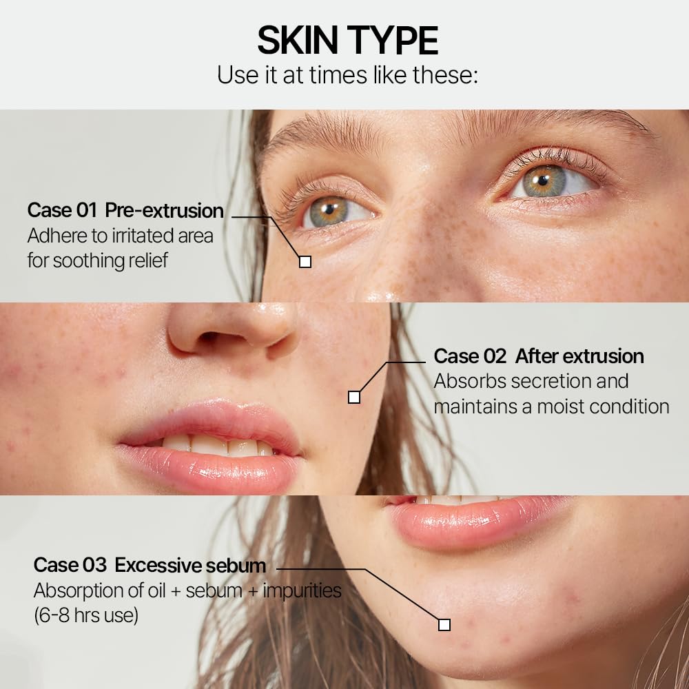 Parnell Cicamanu Madecassoside patch for gentle skin resilience