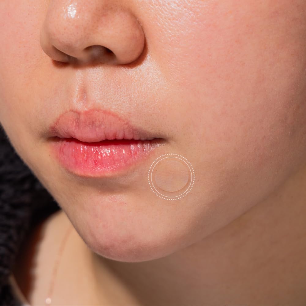 PATCH PRO absorbs fluids to help flatten blemishes with hydrocolloid tech