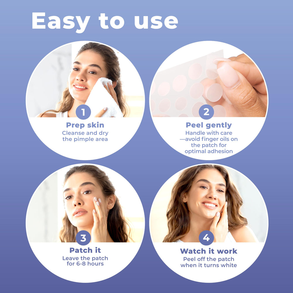 PatchRx Pimple Dots Large on face for larger blemishes.