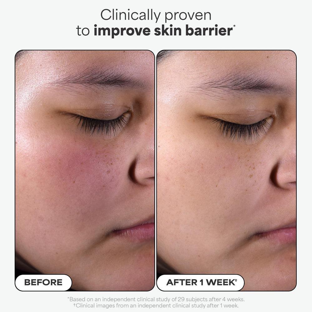 Paula's Choice pads provide gentle exfoliation for face, neck, and body.