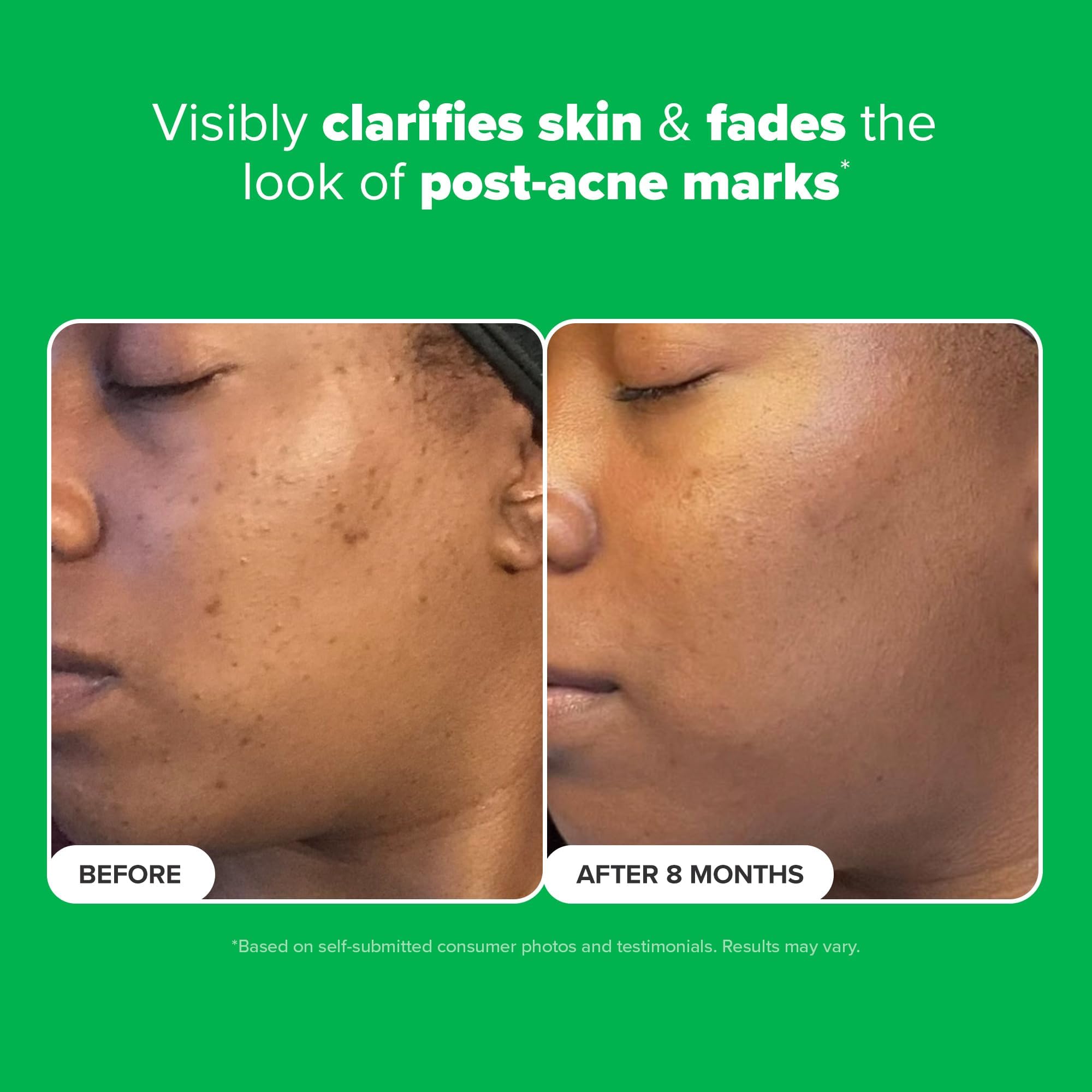Fragrance-free formula suitable for sensitive skin in real life use.