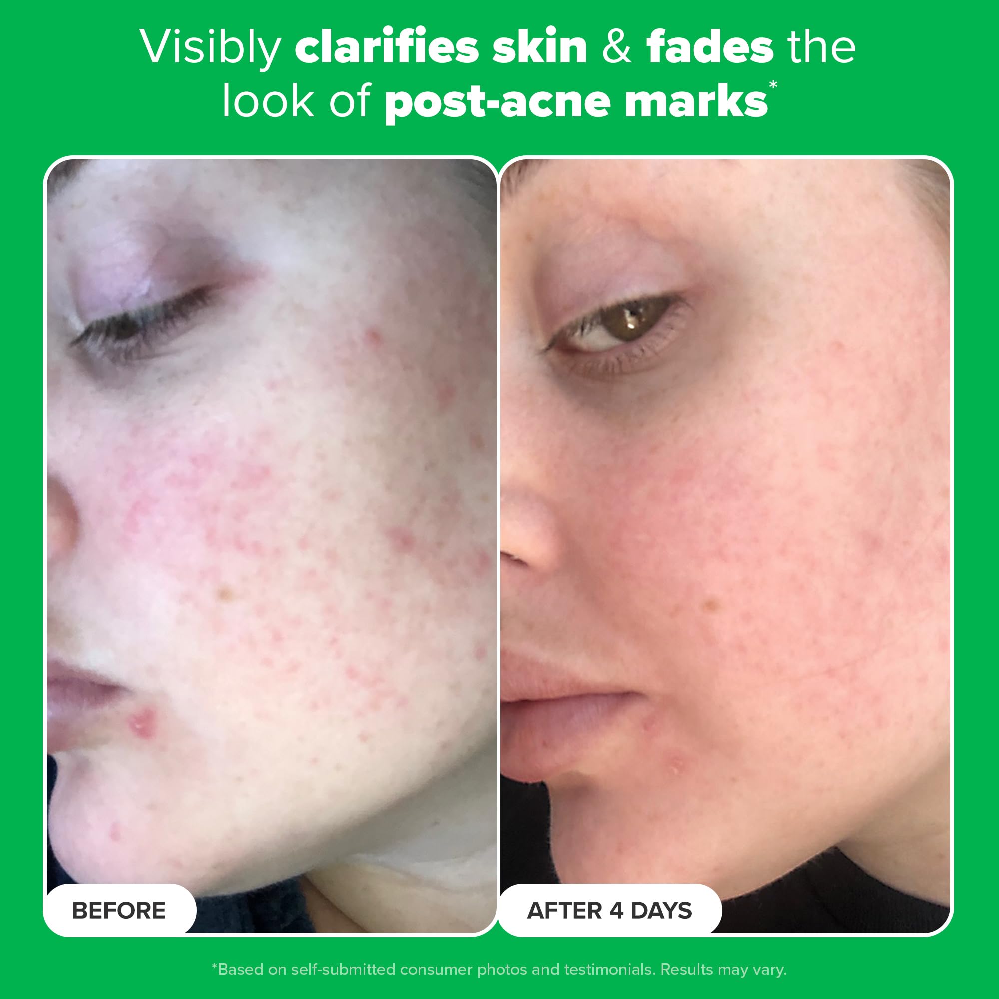 Oil-free serum layers easily with moisturizers for a clean routine.