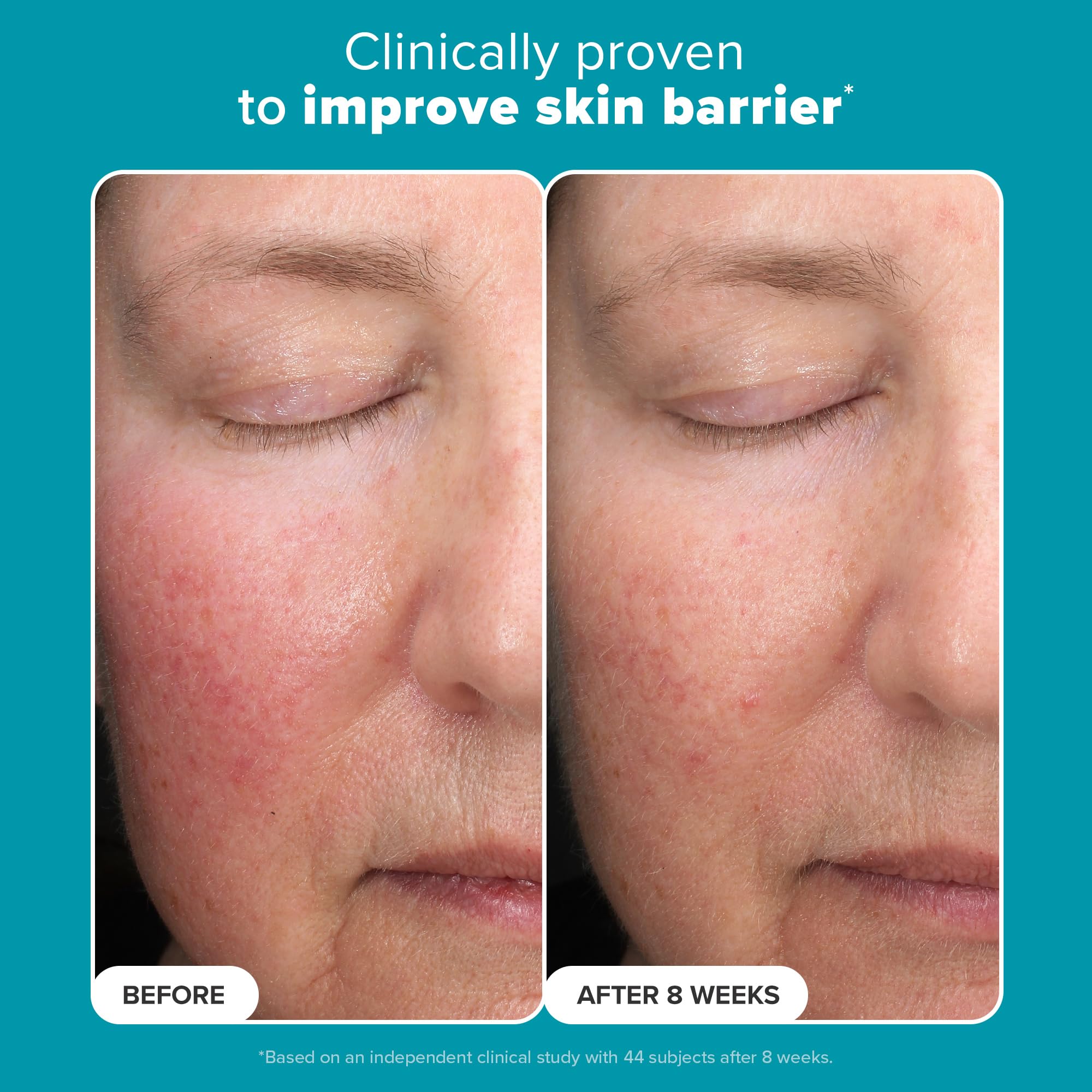 Paula's Choice Liquid Exfoliant 6-percent mandelic-acid—gentle resurfacing with brighter-looking skin.