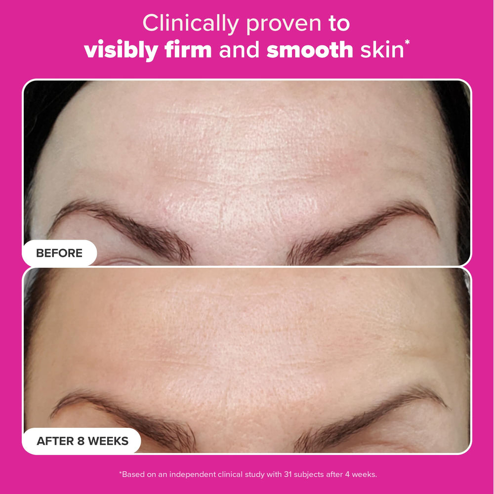 Hyaluronic acid depiction highlighting hydration and plumpness benefits.