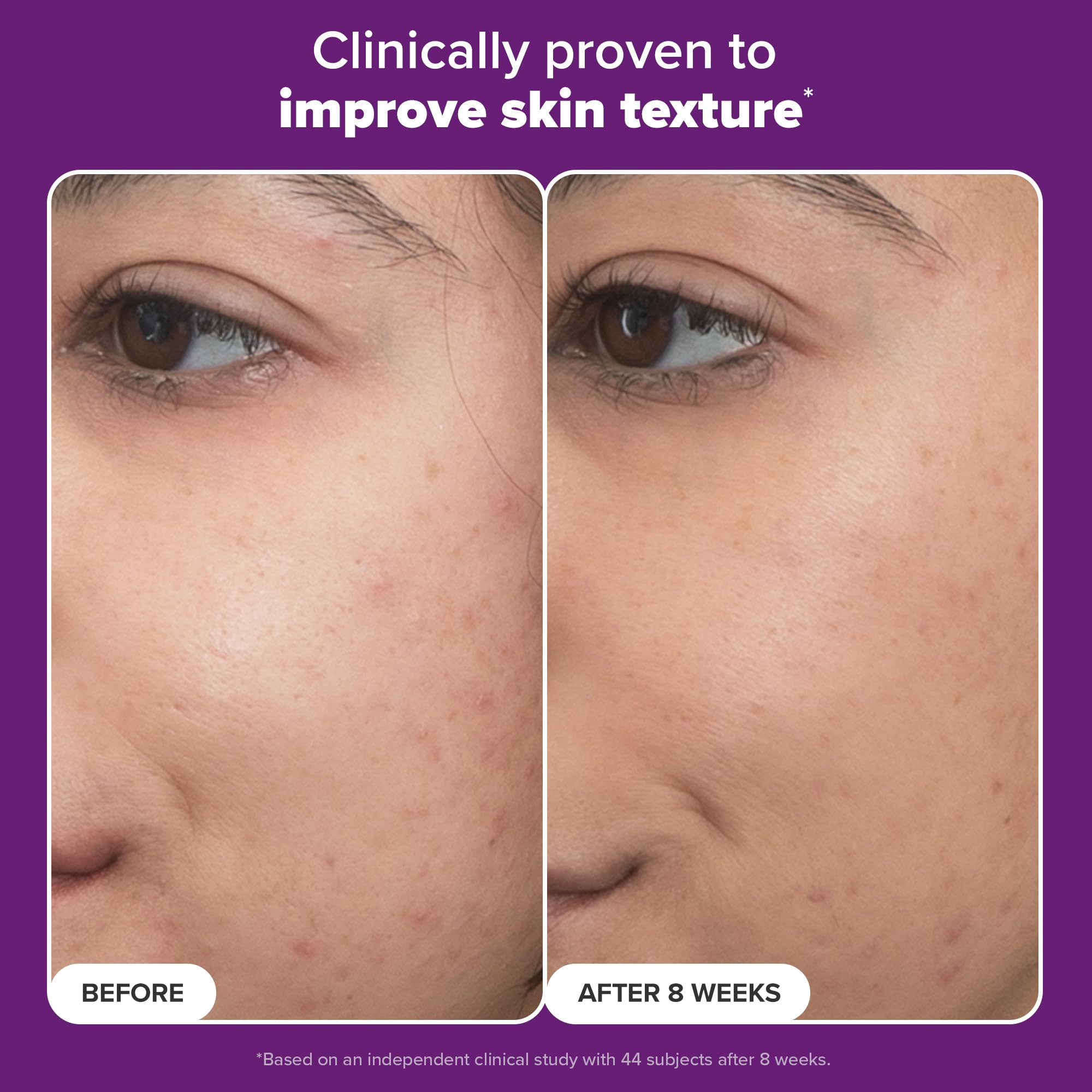Paula's Choice Pro Retinaldehyde bottle with dropper, enabling controlled application for consistent results.