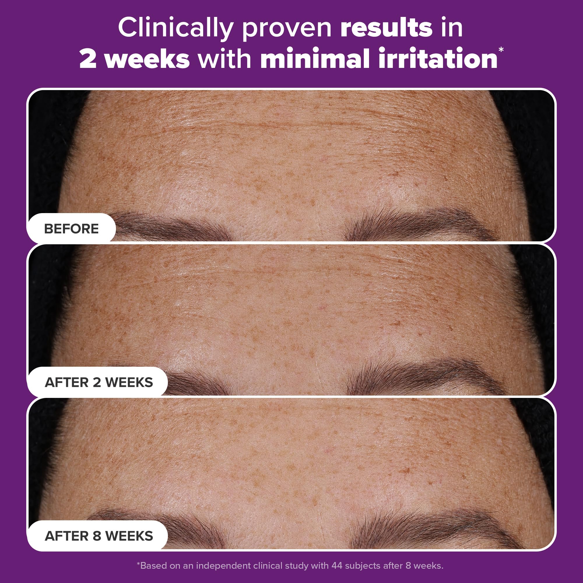 Paula's Choice Pro Retinaldehyde introduces smoother texture and subtle glow.