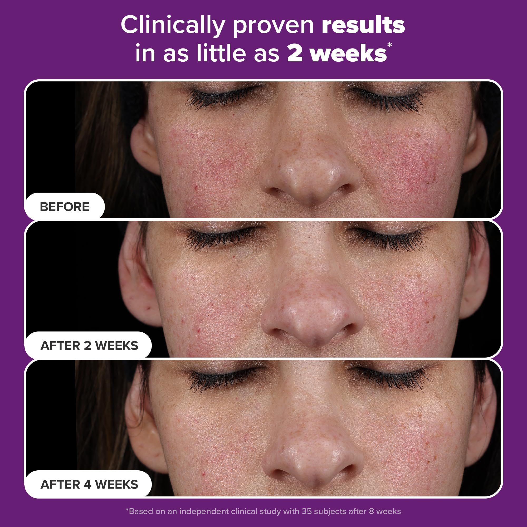 Paula's Choice Pro Retinaldehyde serum bottle highlighting fragrance-free formula for sensitive skin.