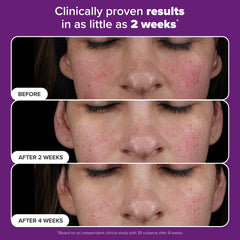 Paula's Choice Pro Retinaldehyde serum bottle highlighting fragrance-free formula for sensitive skin.