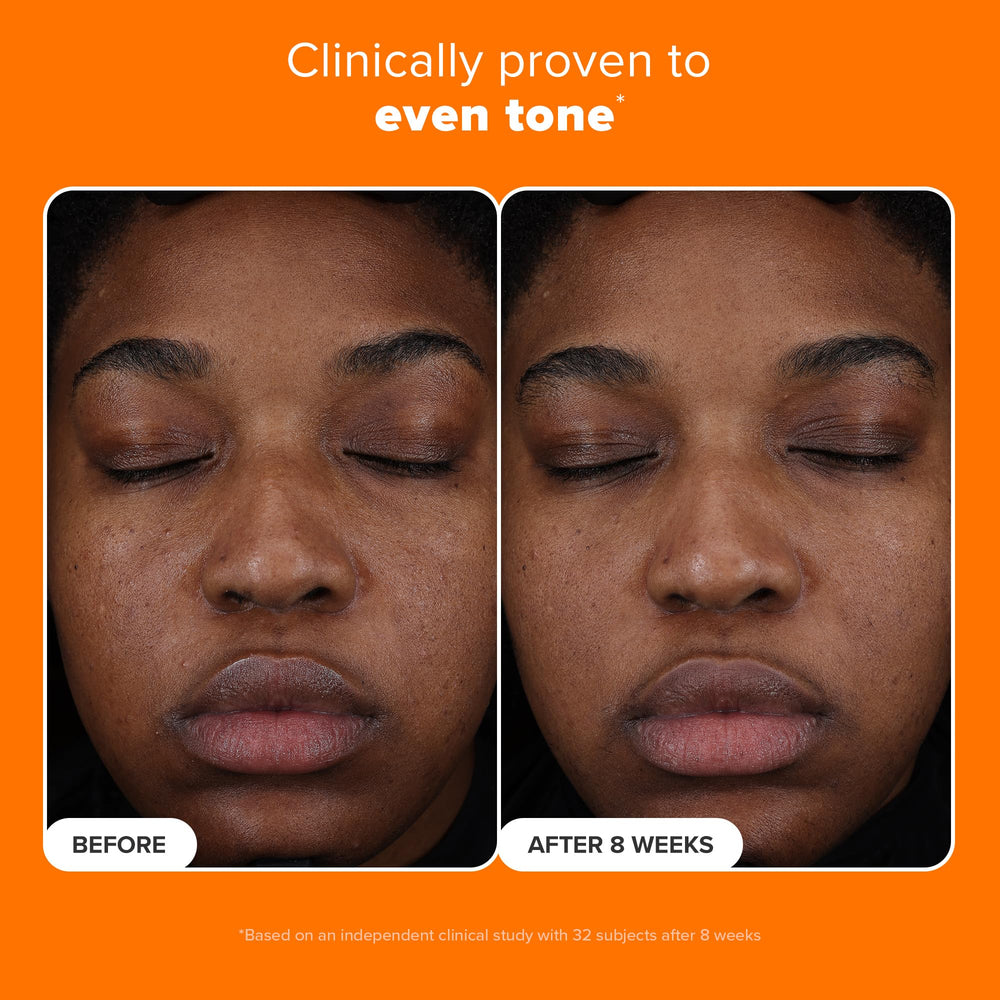 Before-and-after concept colorized image showing improved discoloration with Paula's Choice.