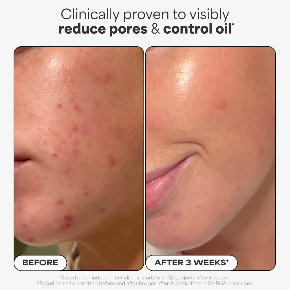 Paula's Choice 2% BHA brightening tone promotes a more even complexion
