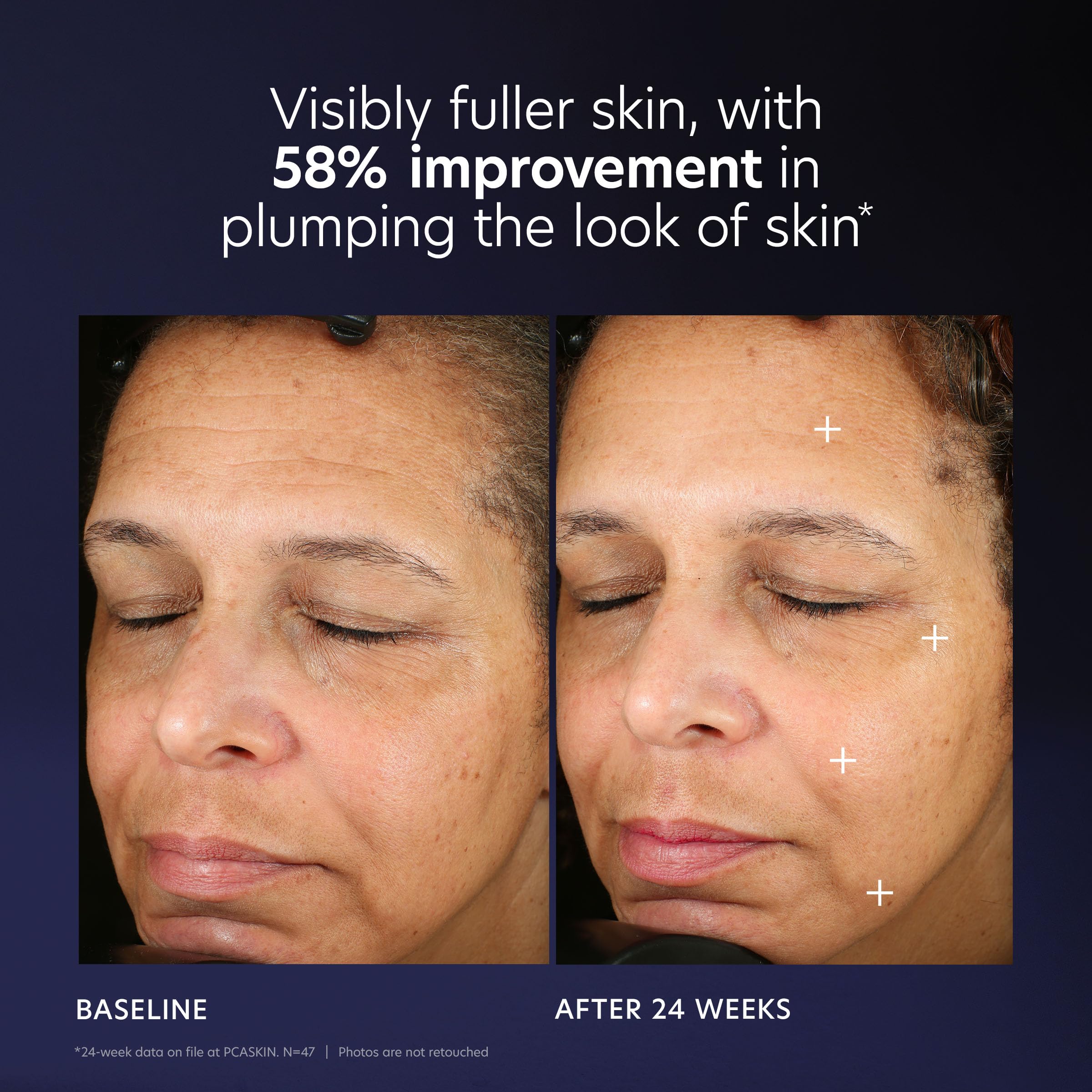 PCA SKIN Pro Max age renewal close-up highlights hydration