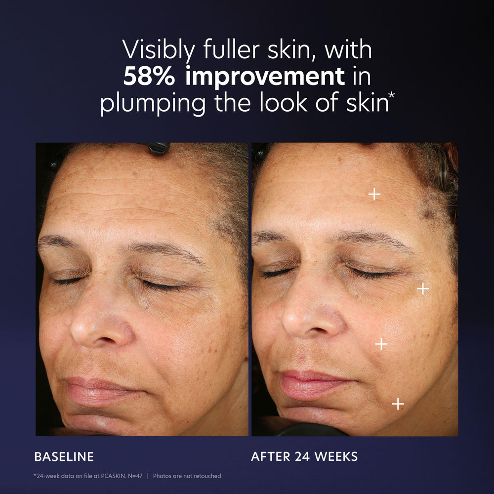 PCA SKIN Pro Max age renewal close-up highlights hydration