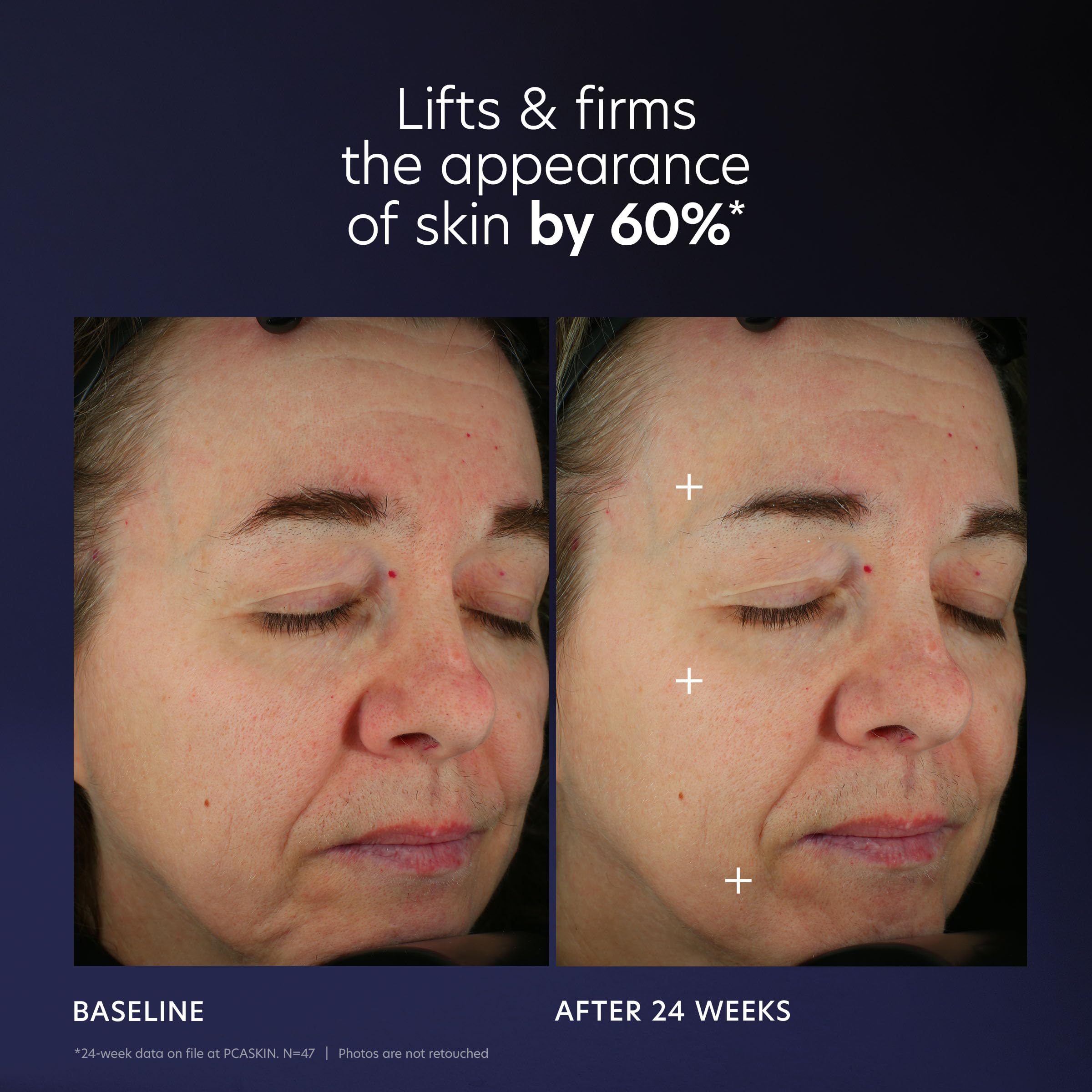PCA SKIN Pro Max Age Renewal close-up highlights hydration