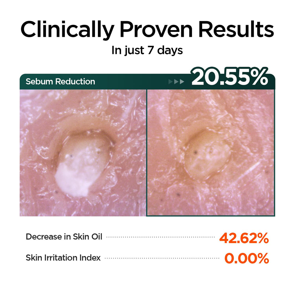P.CALM Barrier Cycle Sheet Mask packaging emphasizing 30-day vegan regimen.