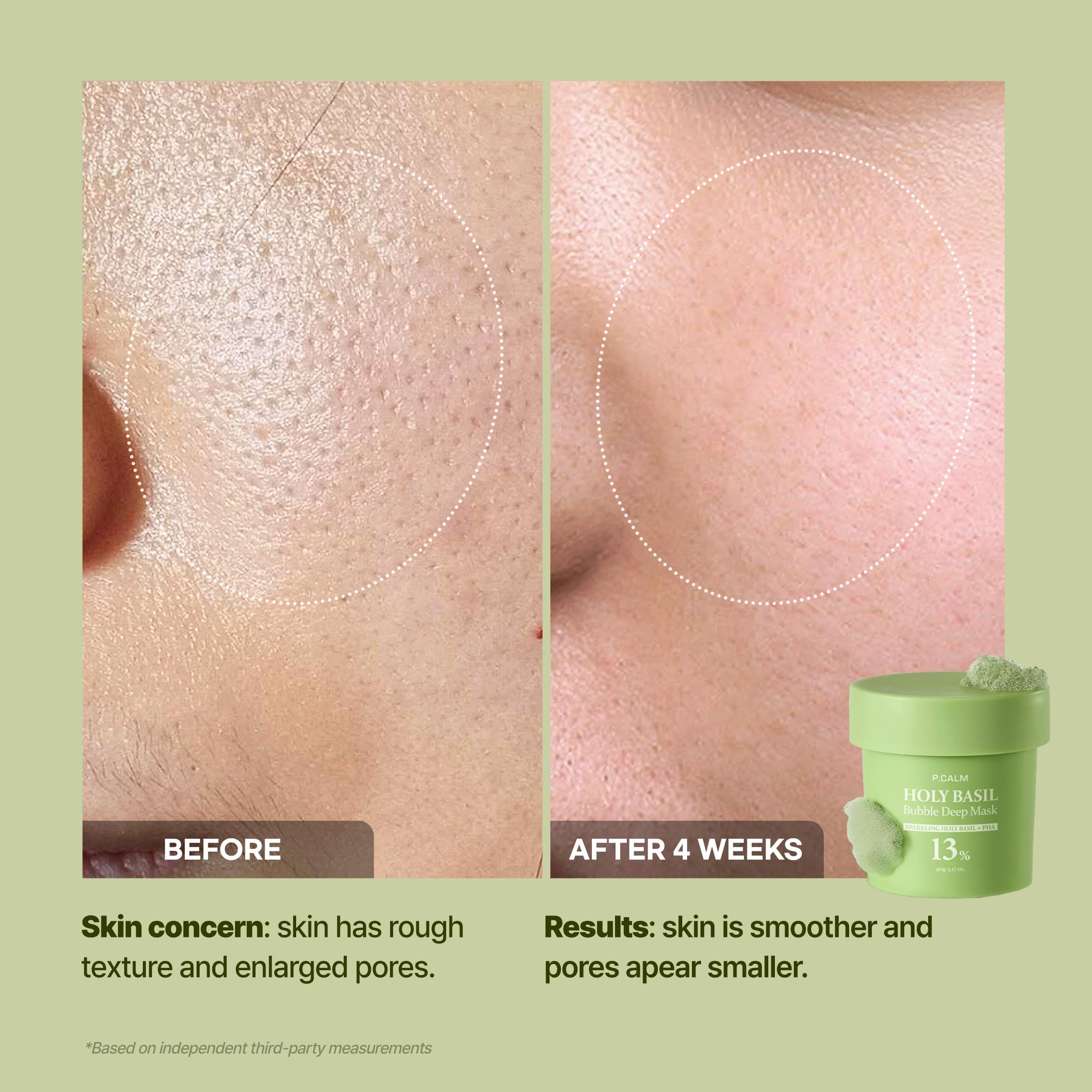 Detail of P.CALM formula targeting blackheads with deep cleansing action.