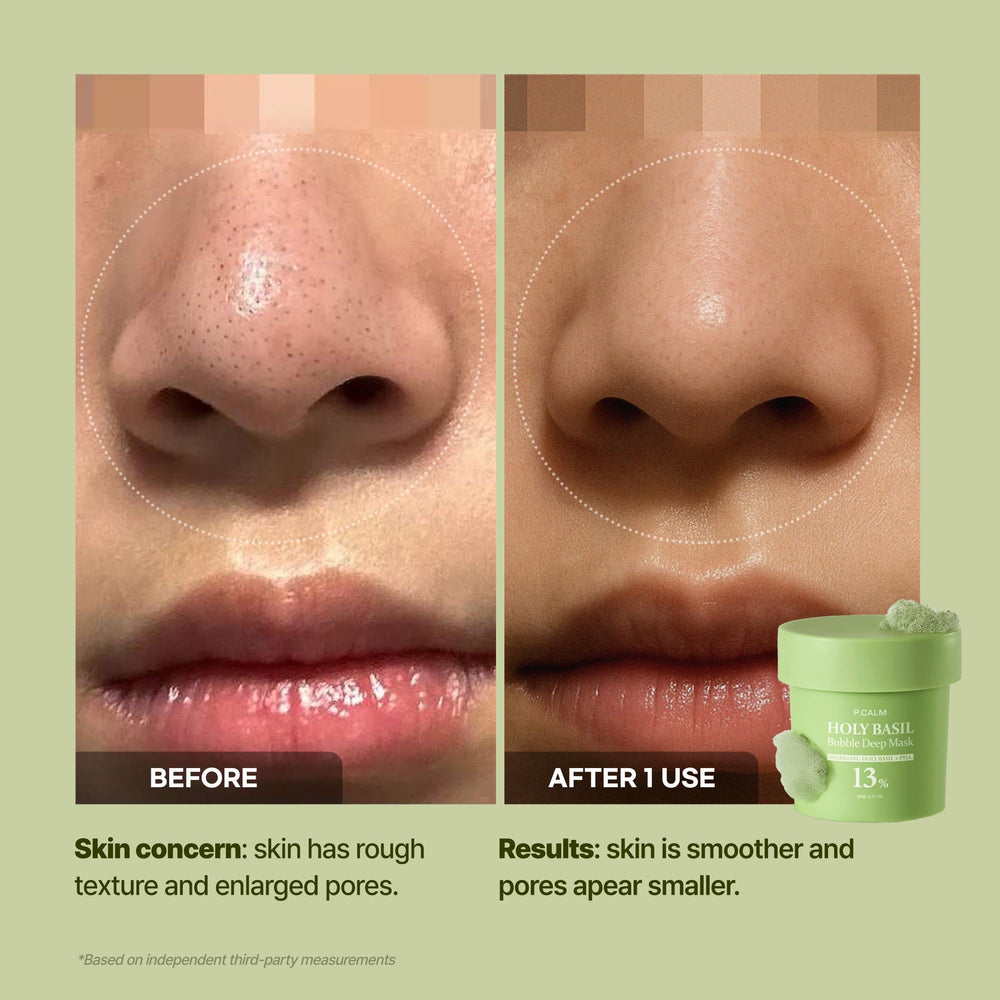 Close-up of P.CALM bubble mask cleansing pores for a refreshed complexion.