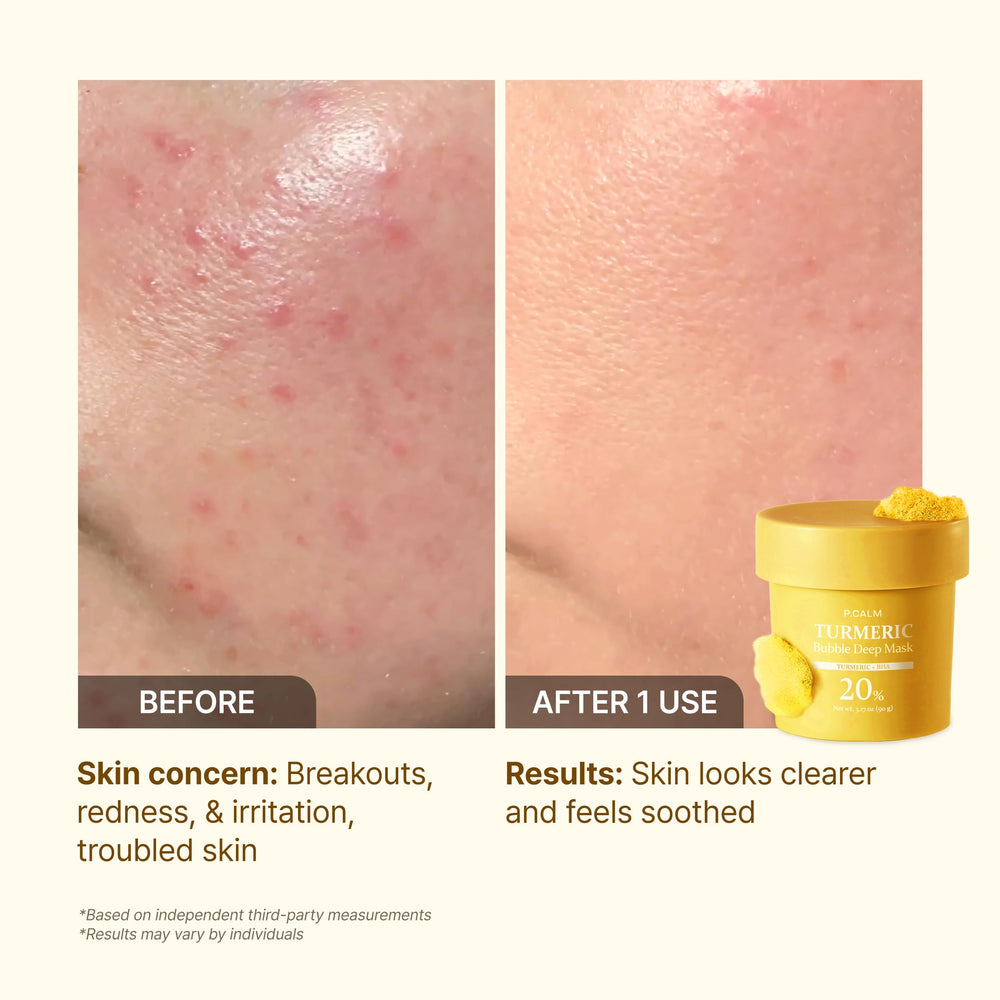 P.CALM Turmeric soothing redness close-up suggests calm, even tone.