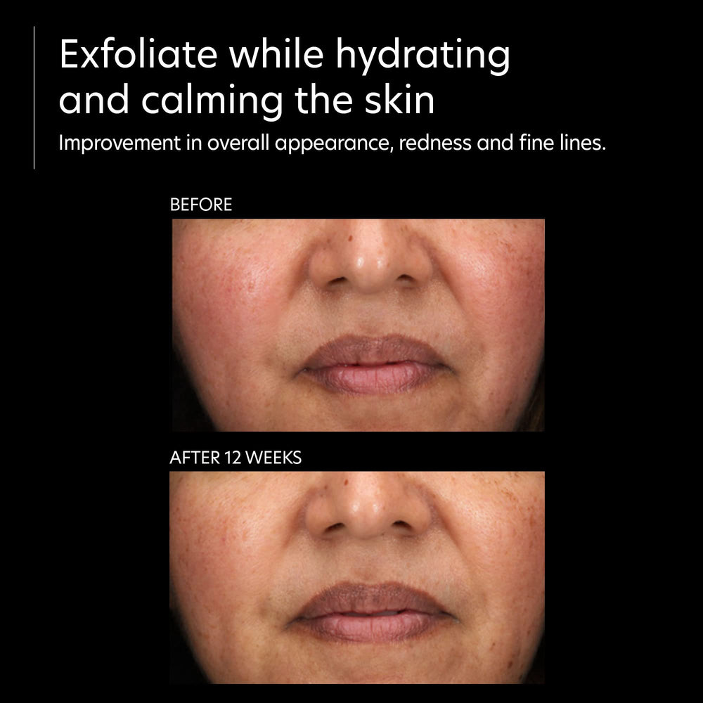 PCA SKIN Resurfacing Serum ingredient close-up shows glycolic-arginine and prickly pear.