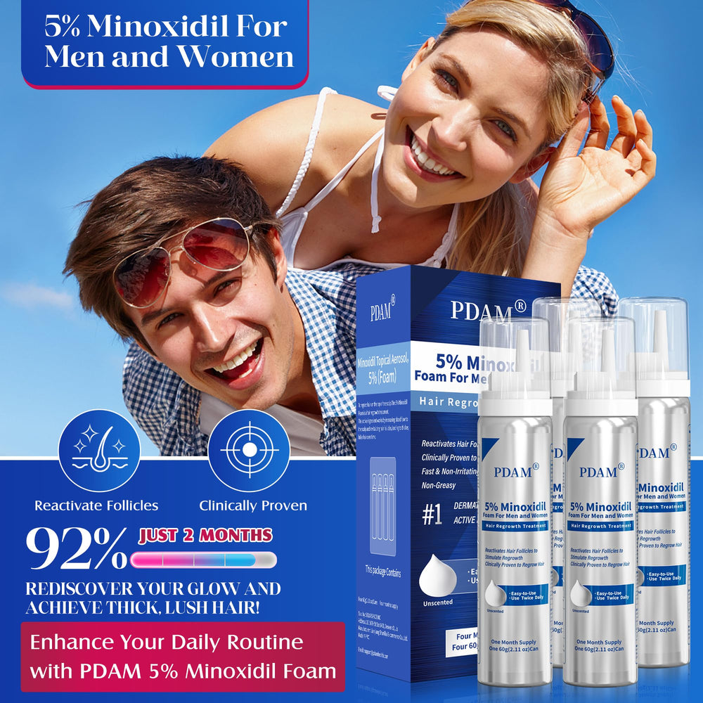 Pdam Minoxidil foam applied to beard area for coverage and thickness.