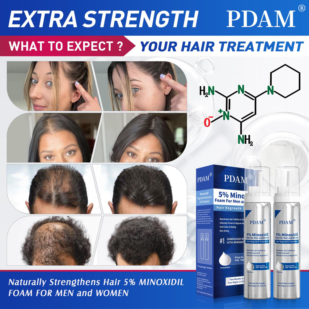 Pdam minoxidil foam dispenser in action for precise application.