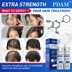 Pdam minoxidil foam dispenser in action for precise application.