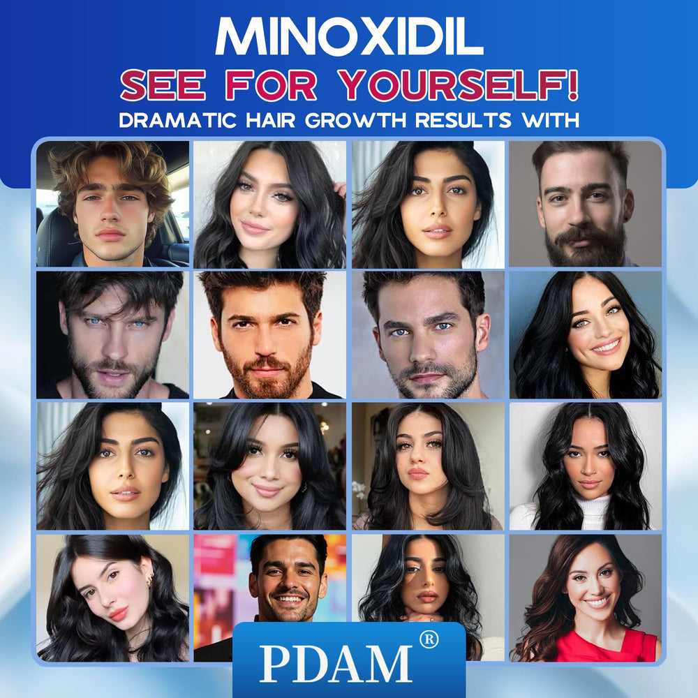 Pdam Minoxidil foam label highlights 5% concentration.