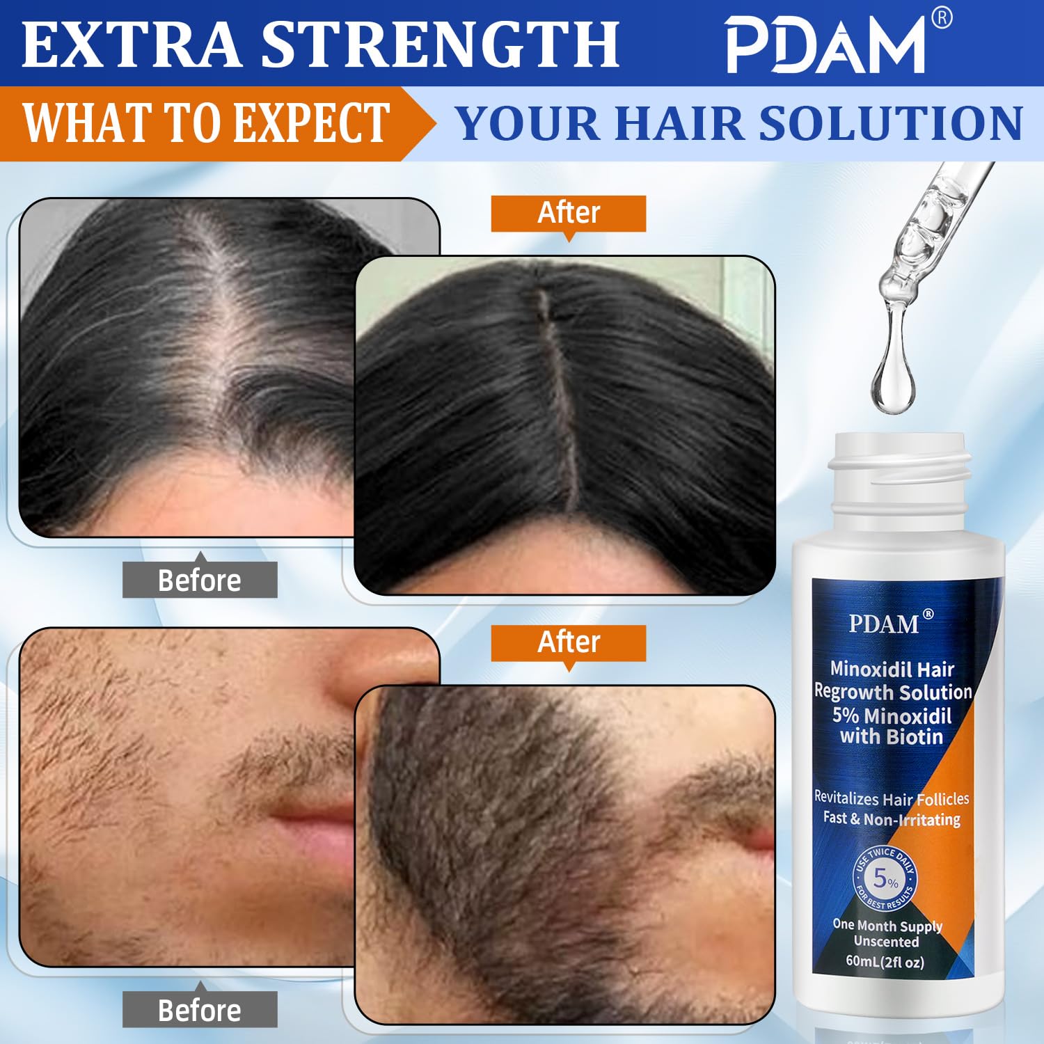 Pdam Minoxidil no parabens label highlights clean formula.