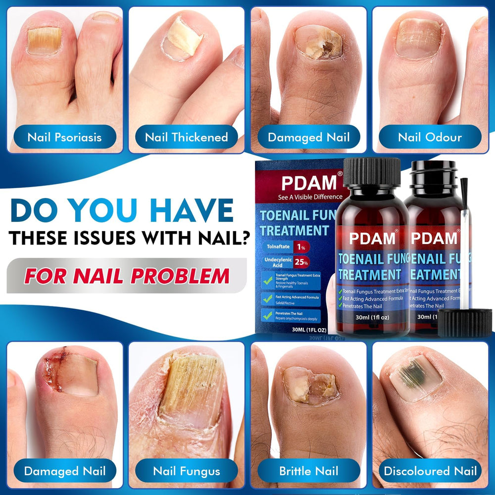PDAM nail growth serum application on damaged nails.